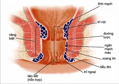 benh-tri(1).jpg