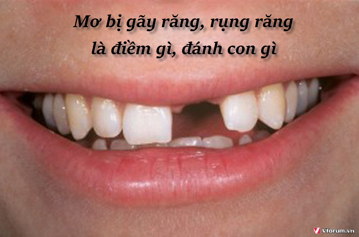 mo-bi-gay-rang-rung-rang-la-diem-gi-danh-con-gi.png